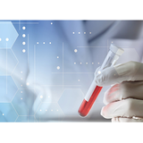 术前检查（Hepatitis and Retrovirus）