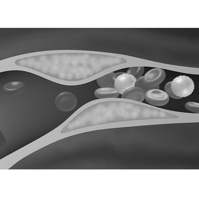高血压（Hypertension）